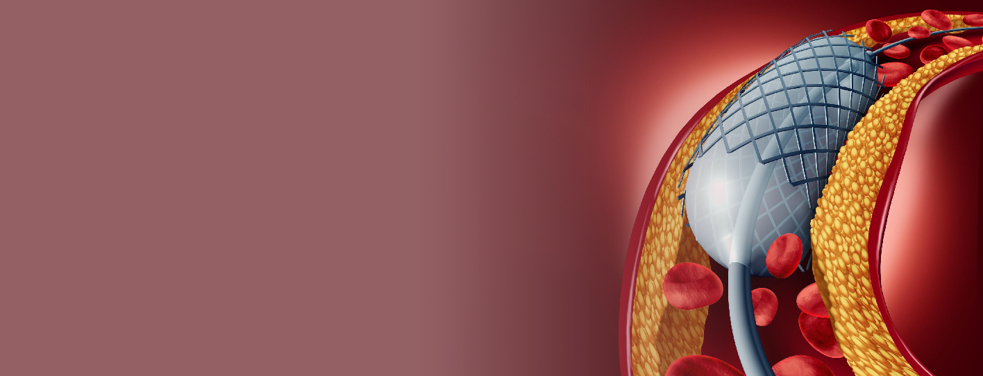 Angiography and Angioplasty: Understanding the Procedures